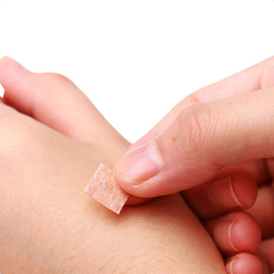 प्लास्टिक हैंडल एक्यूपंक्चर प्रेस सुई GB 2024-2016 प्रभावी और आरामदायक उपचार के लिए सुरक्षा मानक