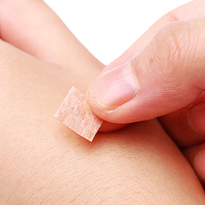 चीनी चिकित्सा उपकरण के लिए एक्यू प्रेस सुई के लाभों का अनुभव करें